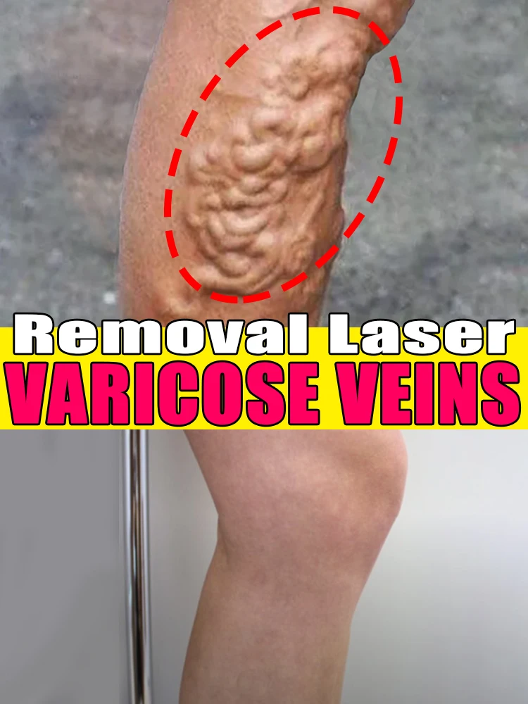 The mild form can be cured, and the severe form can be inhibited